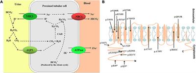 Case report: Altered pre-mRNA splicing caused by intronic variant c.1499 + 1G > A in the SLC4A4 gene
